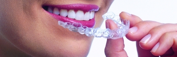 Invisalign
